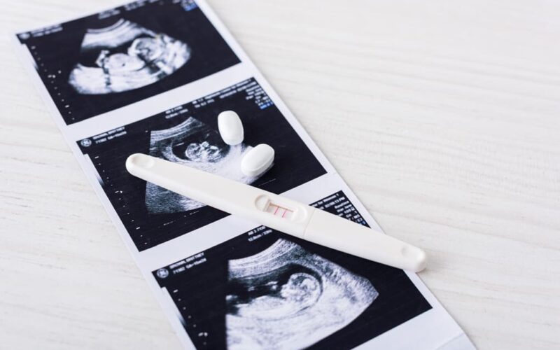 Tratamiento de fertilidad con clomifeno: guía práctica para personas en  Bolivia